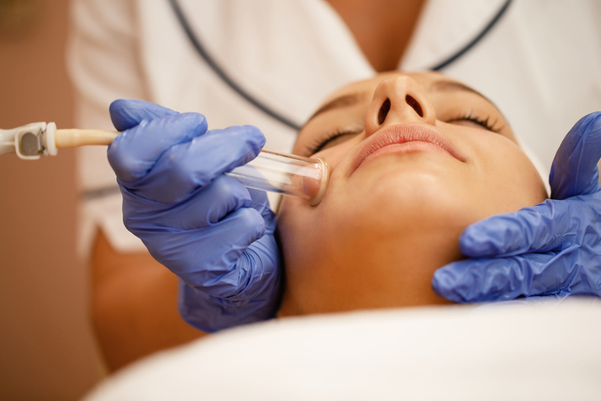Close-up of woman having vacuum facial treatment at beauty spa.