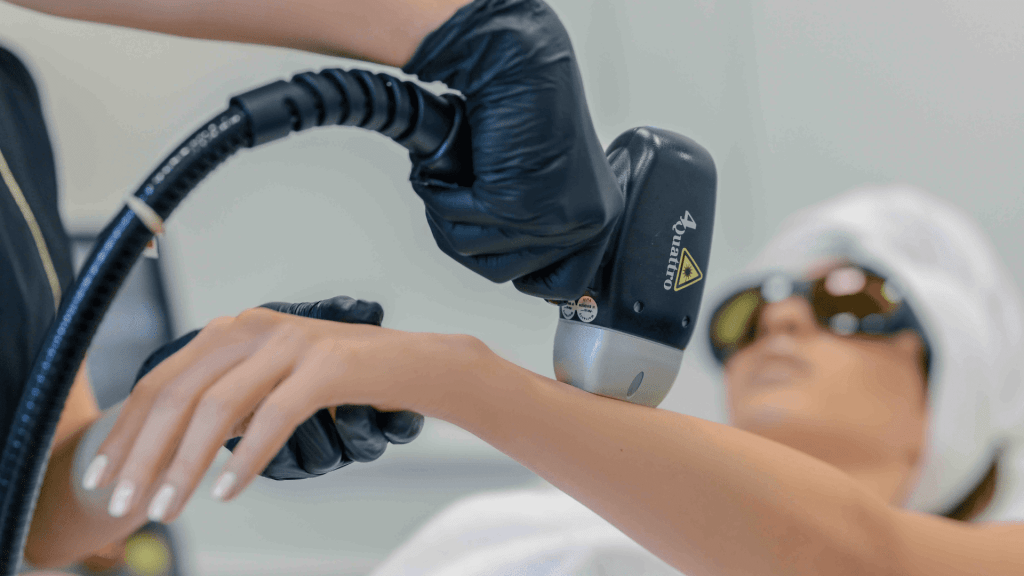 Permanent Laser Hair Removal with Soprano Titanium