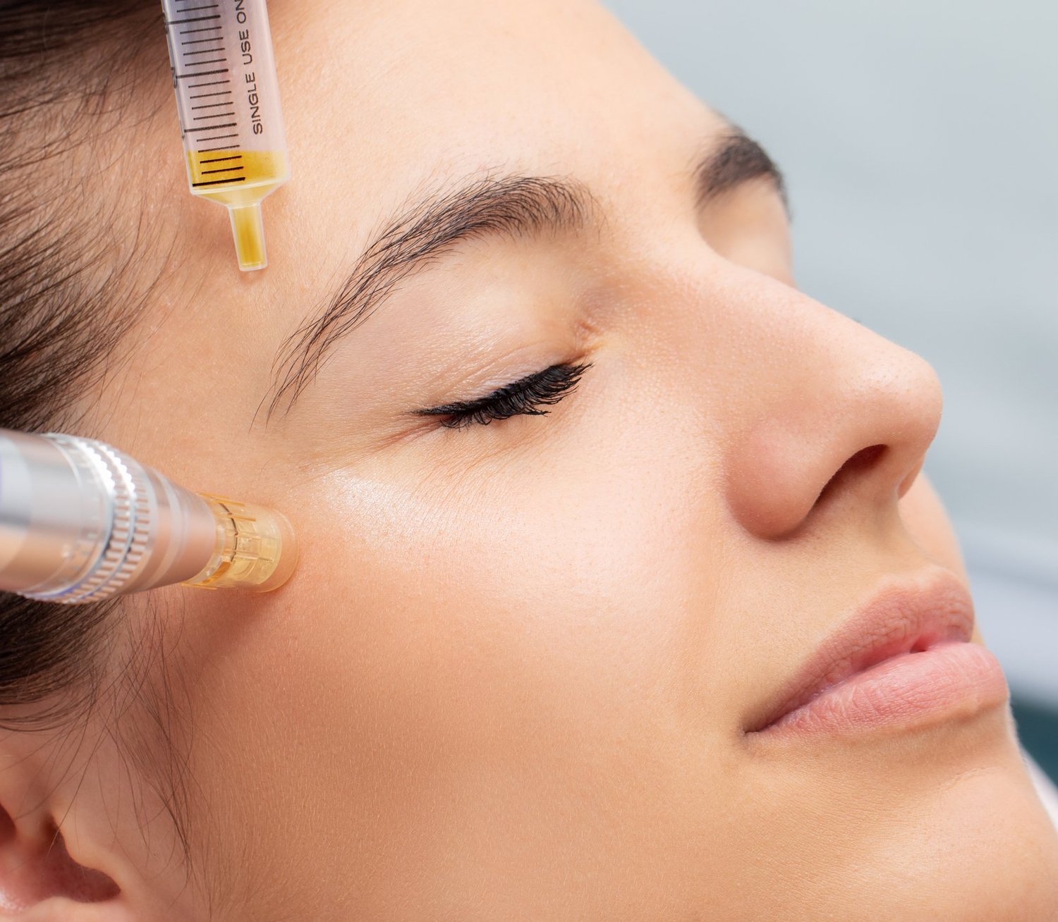 Vampire Facial (PRP) in Nairobi-Karen & Mombasa – The Secret to Radiant, Youthful Skin