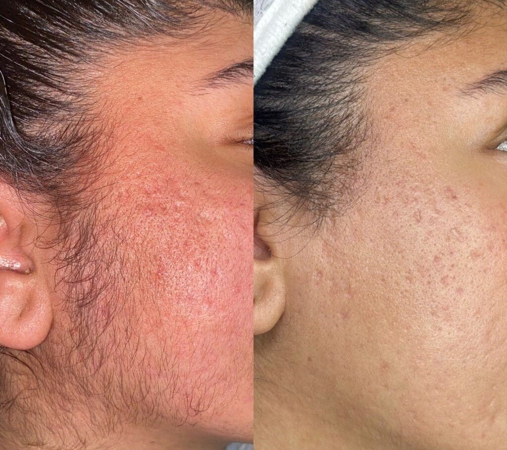 12-1024×1024 12-1024x1024