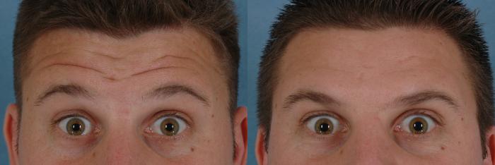 neuromodulators-253-view-1-thumbnail