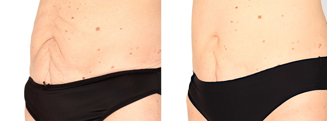 zdjecie_metamorfozy_102_4 zdjecie_metamorfozy_102_4